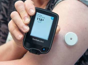 Continuous Glucose Monitoring System