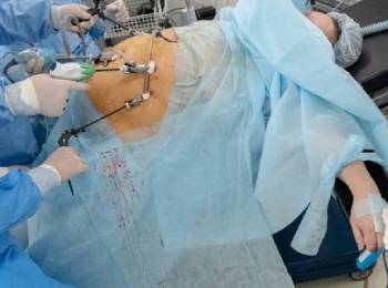 Endoscopy & Colonoscopy